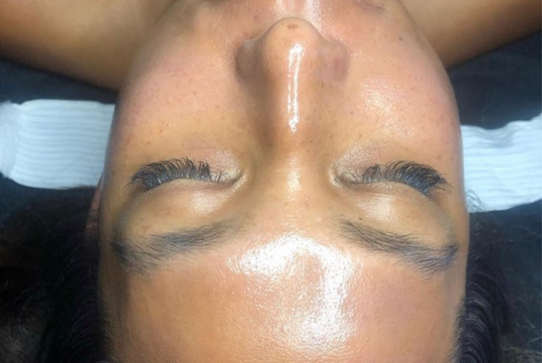 Client with glowing, smooth skin after glass skin treatment at Catara Med Spa