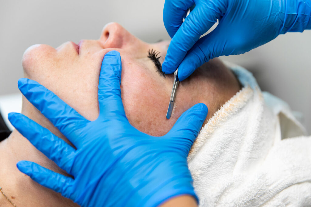 Dermaplaning facial at Catara Med Spa in Algonquin, IL. Gently removes dead skin and peach fuzz for a smoother, brighter complexion.