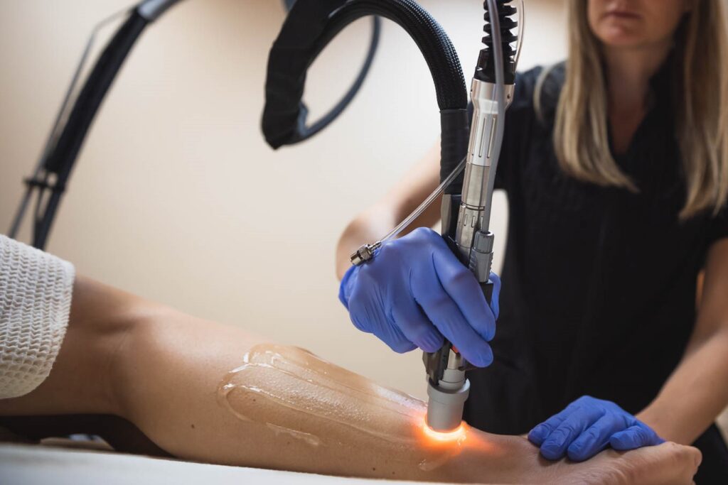 Laser hair removal at Catara Med Spa in Algonquin, IL. Handheld device targets hair follicles for smooth, long-lasting results.