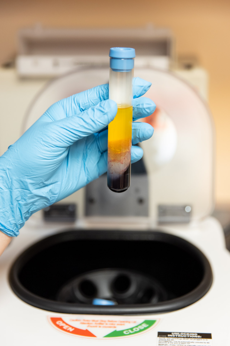 O-Shot PRP preparation at Catara Med Spa in Algonquin, IL. Platelet-rich plasma is drawn and prepared for intimate wellness injection.