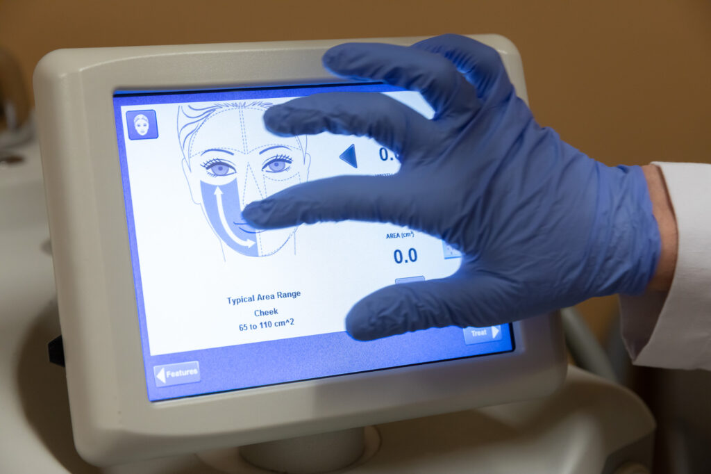 Ultherapy treatment interface at Catara Med Spa in Algonquin, IL for non-invasive facial lifting and ultrasound-guided skin tightening.