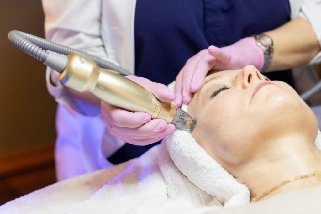 Sylfirm X microneedling device in use during facial rejuvenation