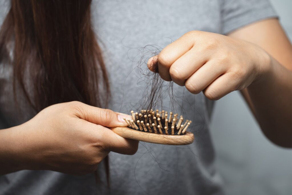 Woman holding hairbrush with visible hair loss, indicating early signs of thinning hair.