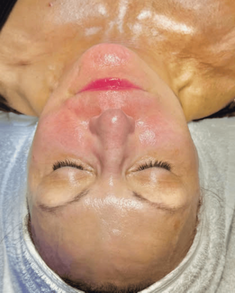 woman receiving hydrating glass facial at catara med spa algonquin il glowing skin treatment for smooth radiant complexion