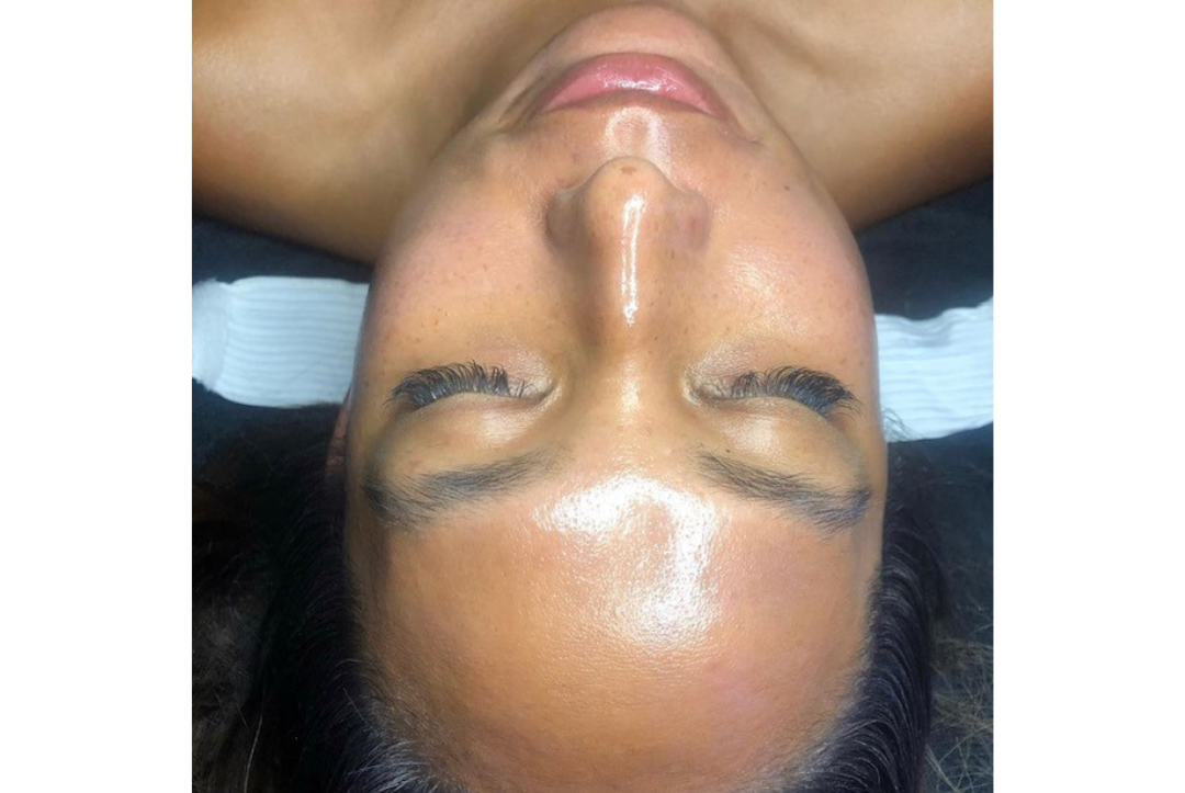 Woman with luminous, dewy skin after facial treatment at Catara Med Spa in Algonquin, IL