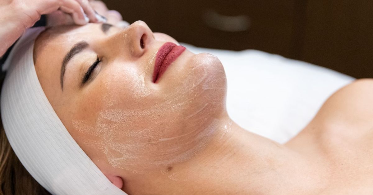 acne facial at Catara Med Spa in Algonquin, IL. Licensed aesthetician performs deep cleansing treatment to reduce breakouts and calm skin