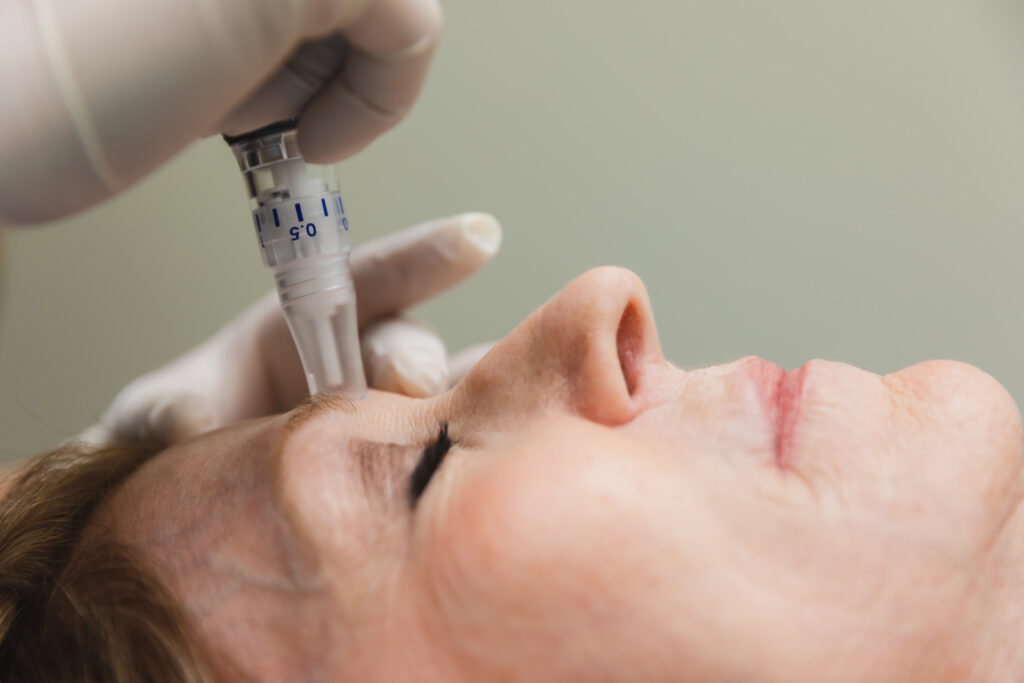 microneedling eyes brow algonquin historic district