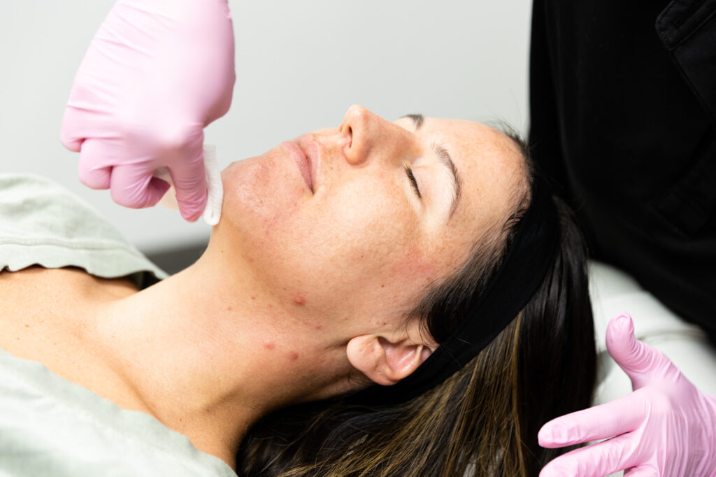 prp microneedling collagen therapy village hall algonquin