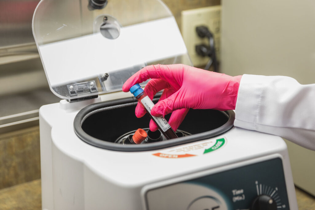 prp centrifuge blood processing algonquin