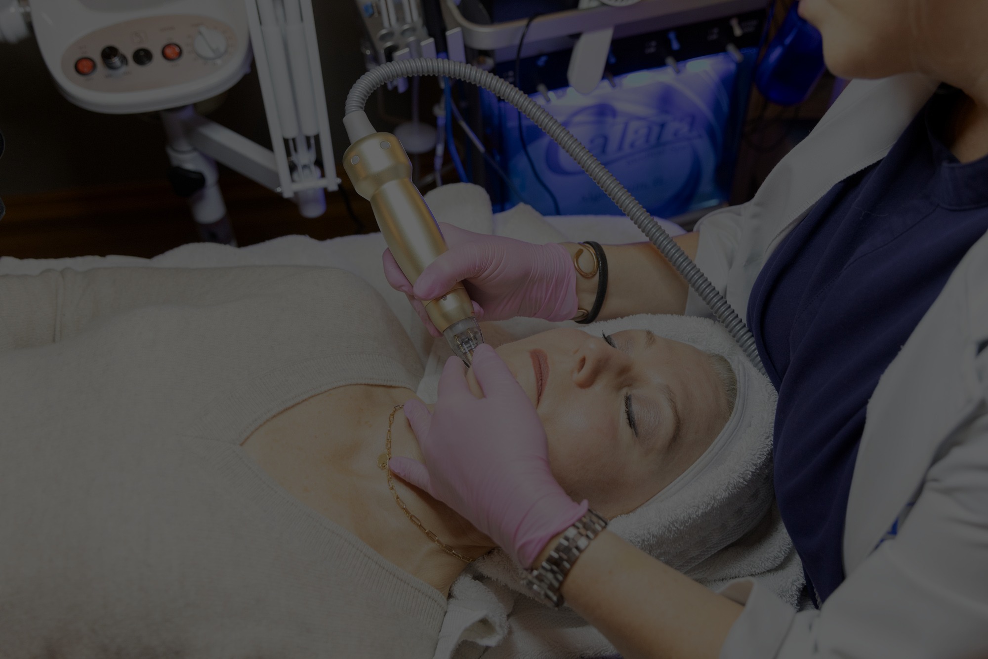 RF microneedling procedure at Catara Med Spa in Algonquin for wrinkle reduction