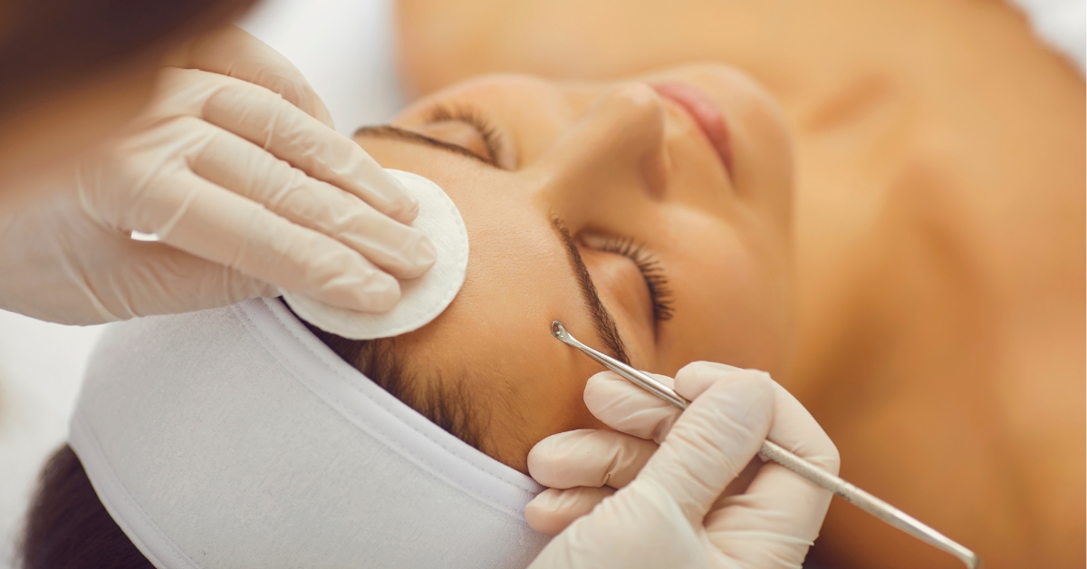 Esthetician performing hormonal acne treatment with extraction tool during facial at Catara Med Spa.