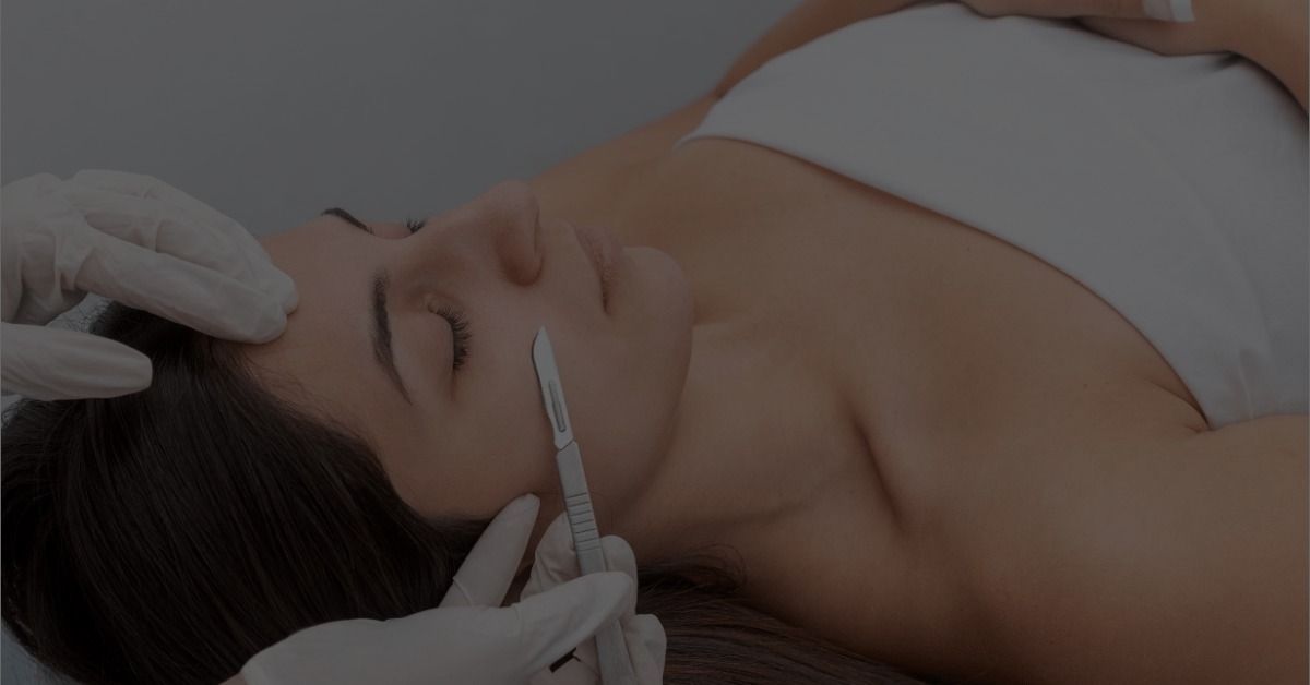 Professional dermaplaning treatment at Catara Med Spa in Algonquin, IL — exfoliation and peach fuzz removal for smoother, brighter skin.