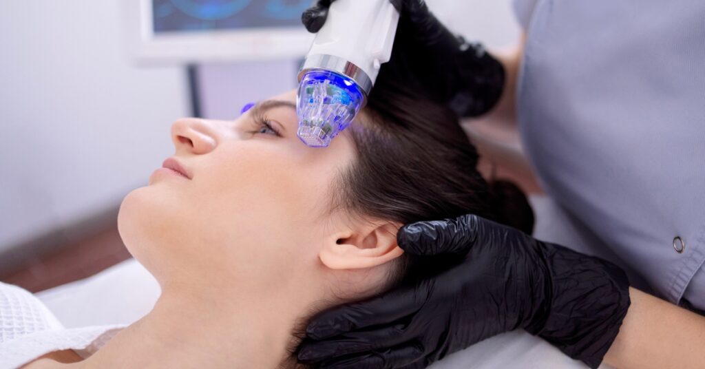 RF microneedling treatment for smoother, firmer skin at Catara Med Spa. RF Microneedling Cost
