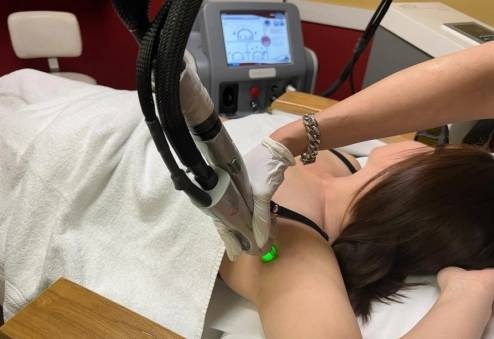 Cherry angioma removal treatment with advanced laser technology at Catara Med Spa in Algonquin, IL. Safe and precise vascular skin therapy