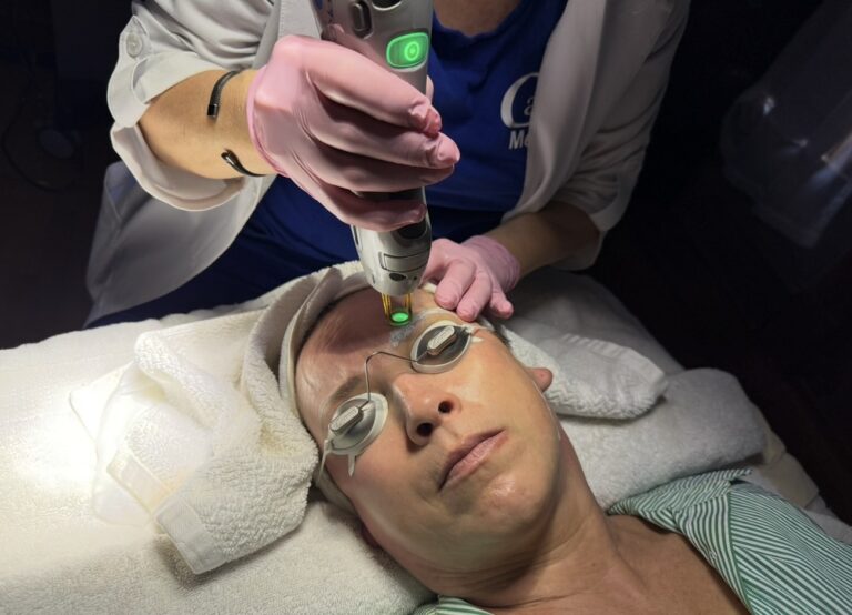 Advanced Botox Booster Laser treatment at Catara Med Spa in Algonquin, IL to enhance collagen, smooth fine lines, and rejuvenate skin.