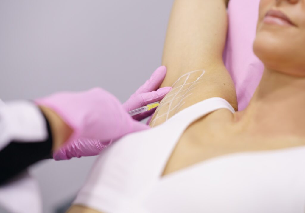 Underarm injection treatment for excessive sweating at Catara Med Spa in Algonquin, IL. Personalized medical care for long-lasting results.