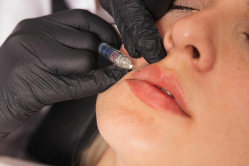 lip filler injection algonquin il catara medical spa